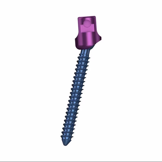 Canwell Medical Mis Titanium Pedicle Screw Medical, Spinal Locking Screw